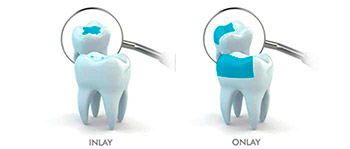 Ocean Dental Cancun - Homepage - Book Direct With Clinic