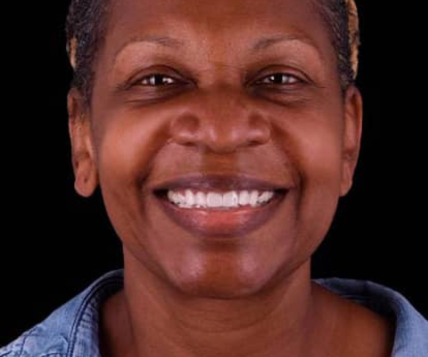 full dental crowns restoration in mexico