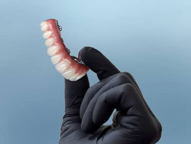 3-on-6 dental implants