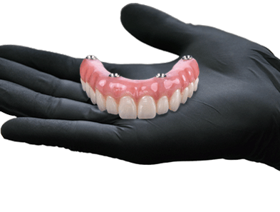 4 in 1 dental implants in mexico