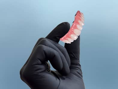 all on 4 dental implants