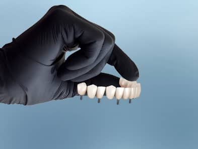 all on 8 dental implants in mexico