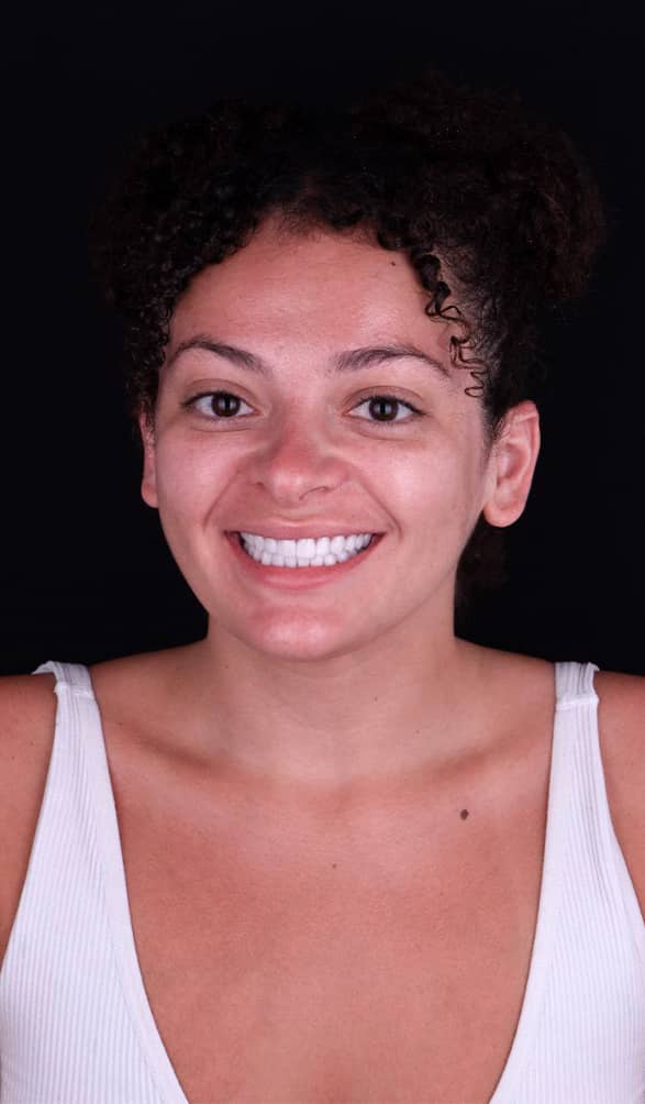 Getting Invisalign [Clear Aligners] in Mexico 4,500 Full Mouth