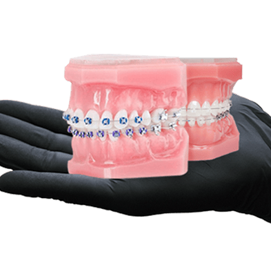 braces in mexico