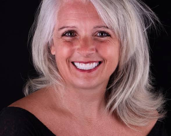 complete mouth dental implants in mexico