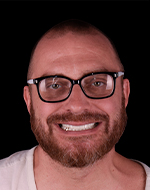 fixed dental bridge in mexico reviews