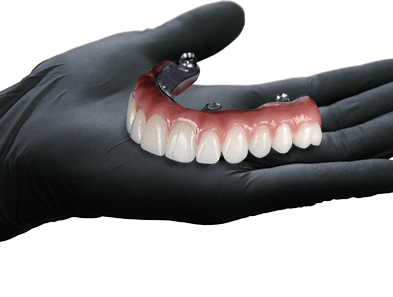 fixed hybrid acrylic all on 4 in mexico