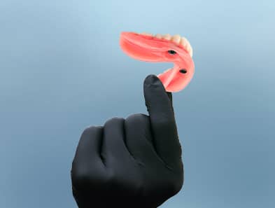 full arch dental implants in mexico