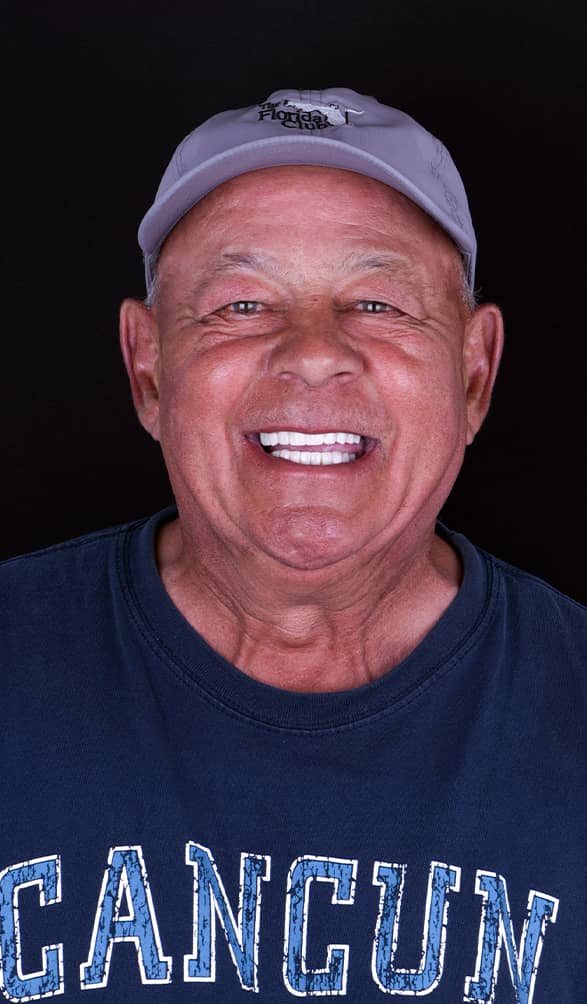 full mouth dental implants in mexico