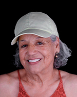full veneers smile makeover in mexico