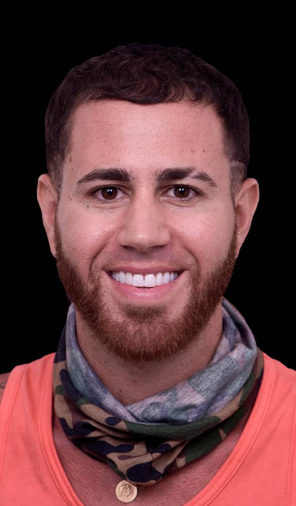 Getting Invisalign [Clear Aligners] in Mexico 4,500 Full Mouth