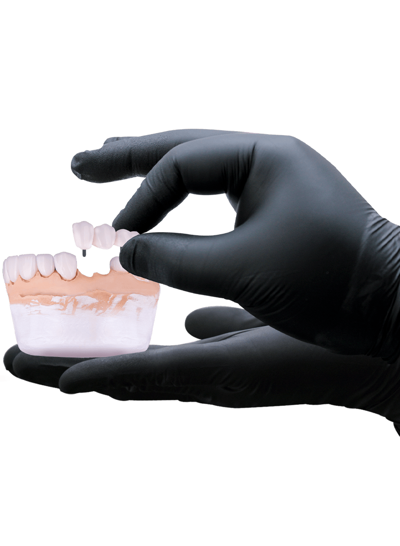 implant retained dental bridges in cancun mexico