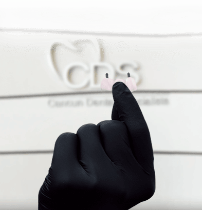 implant supported bridges