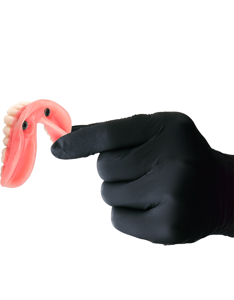 regular dental implant dentures