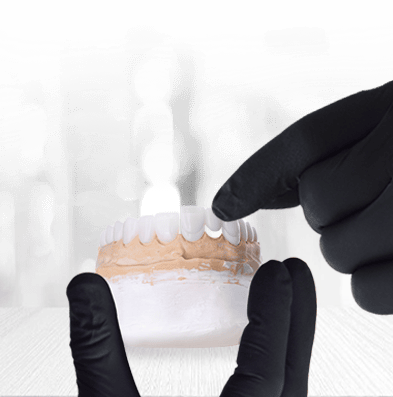 resin bonded dental bridges in mexico
