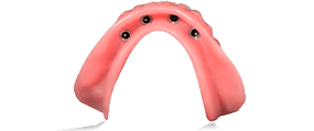 snap on dentures in cancun mexico