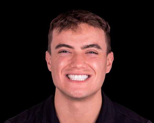 complete dental makeover in mexico