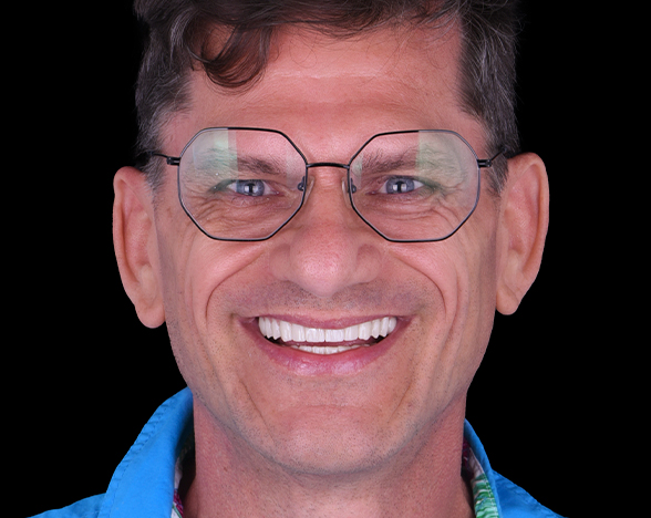 complete dental restoration in cancun mexico