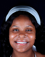 complete mouth veneers in ocean dental cancun