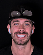 full mouth veneers in mexico