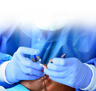 getting root canals in mexico