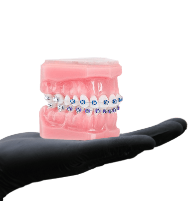 orthodontic braces in mexico