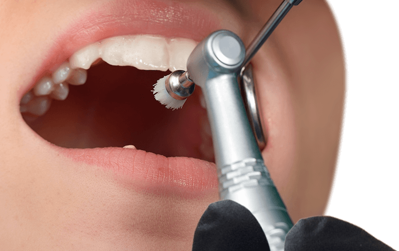 teeth cleaning in cancun mexico