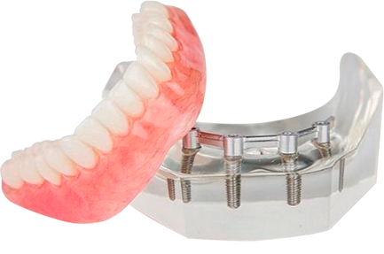 clip on dentures in cancun