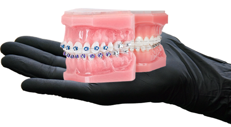 braces in mexico