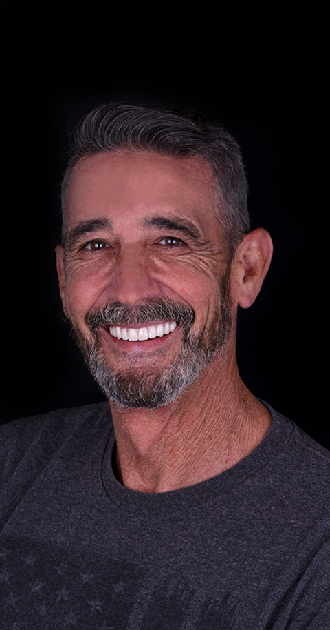 complete dental makeover in mexico