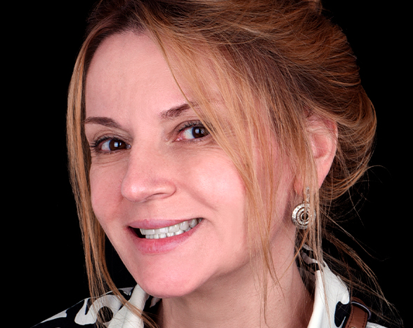 complete mouth makeover in mexico