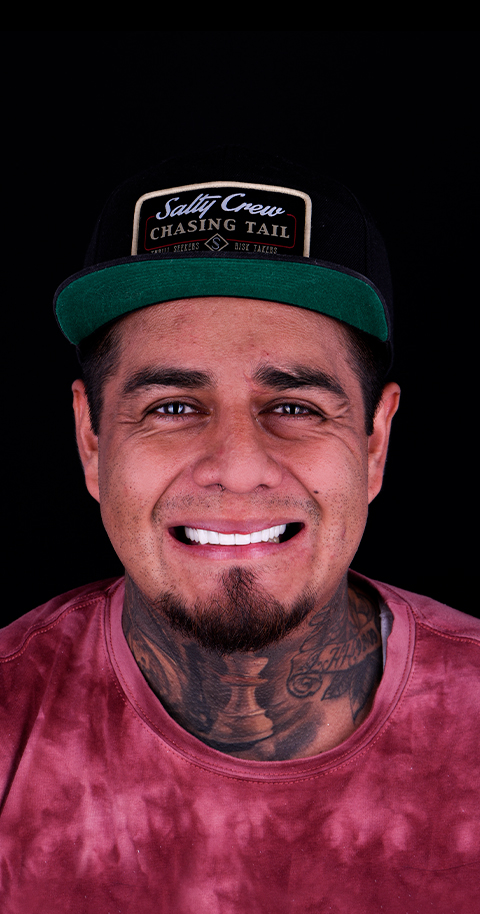 full mouth crowns before and after