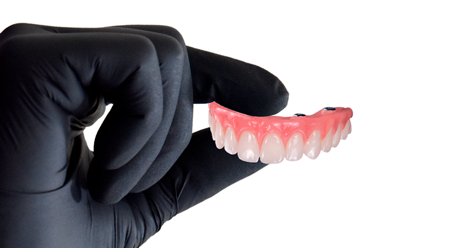full mouth dental implants reconstruction in mexico