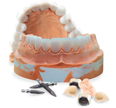 full mouth dental reconstruction in mexico