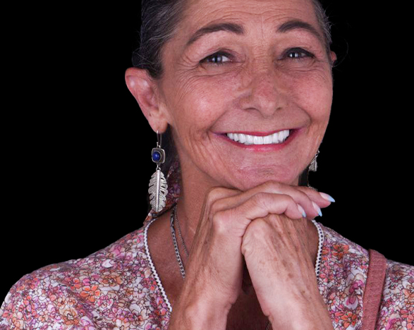 full smile restoration with dental implants in cancun