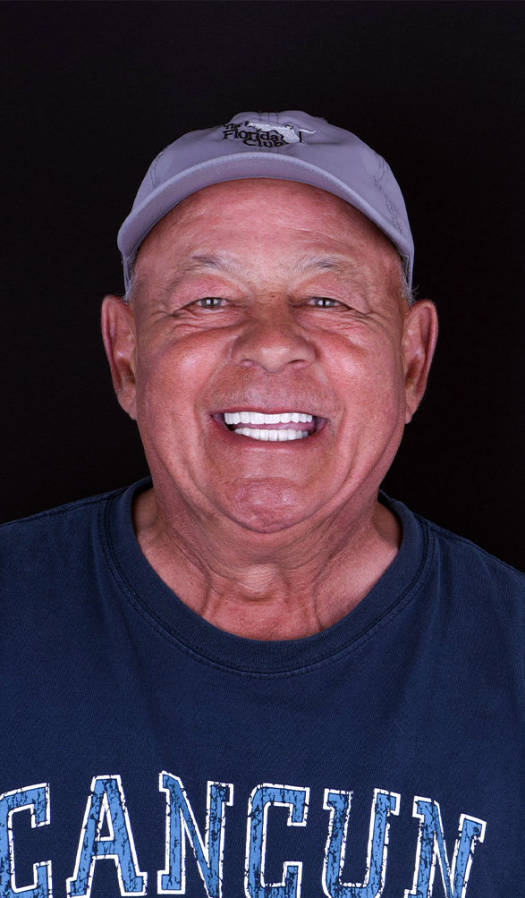 perfect teeth restoration in ocean dental cancun