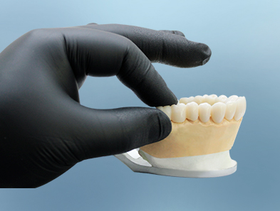 porcelain veneers smile makeover in mexico